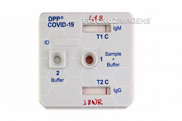 Testagem para Covid-19