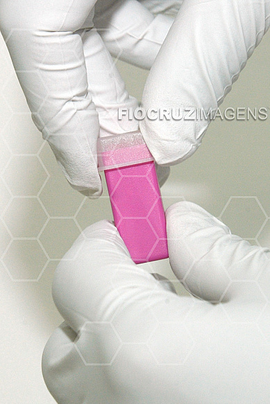 Teste de HIV