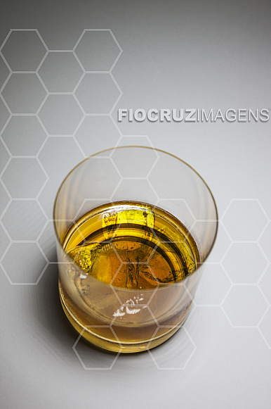 Alcoolismo