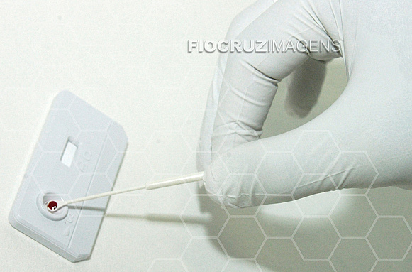 Teste de HIV