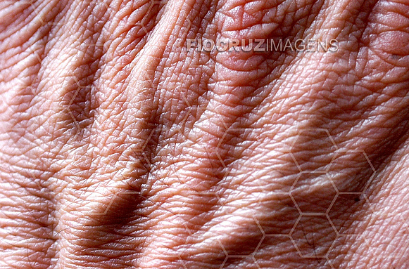 Textura de pele